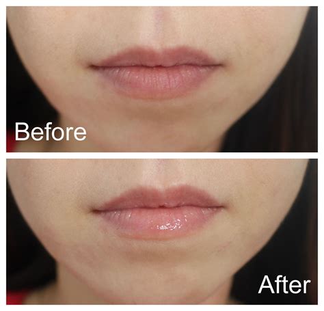 dior lip maximizer before and after|Dior lip gloss cost.